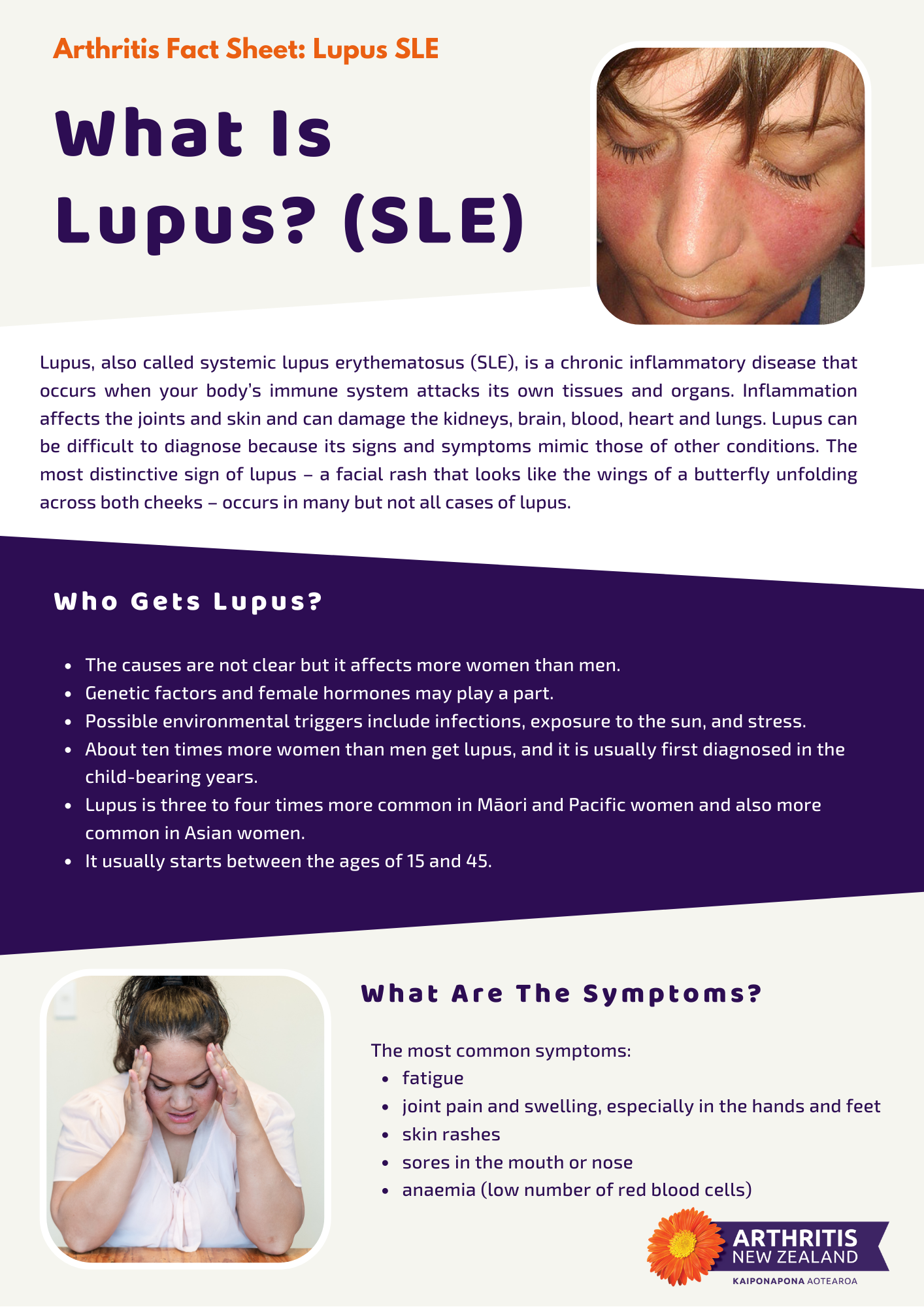 What is lupus